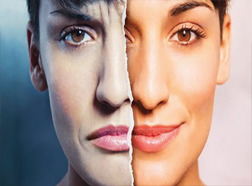 اختلال دوقطبی